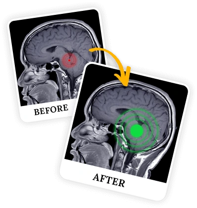The Brain Song Results